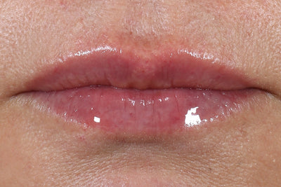After Review Image