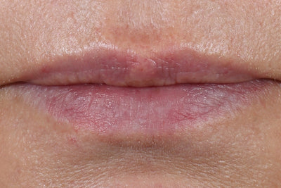 Before Review Image