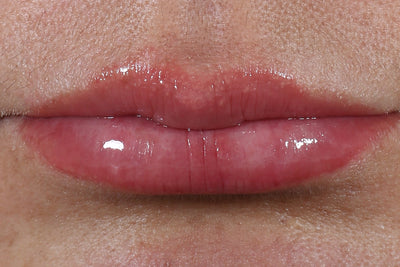 After Review Image