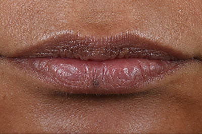 Before Review Image