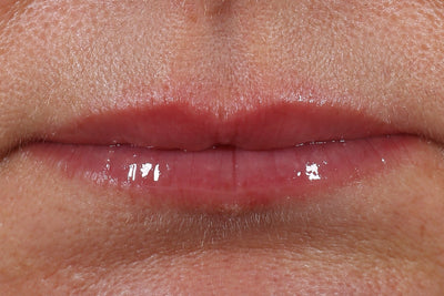 After Review Image